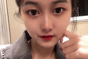 廣州中山三院整形科？下頜角案例介紹+醫(yī)生推薦