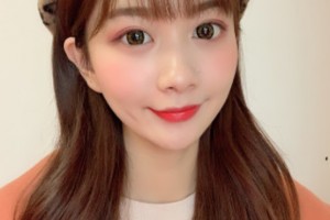 北京聯(lián)合麗格是三甲醫(yī)院?jiǎn)?？附醫(yī)院介紹+雙眼皮果圖