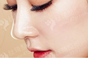 安康做隆鼻醫(yī)院排行榜隆鼻術后體驗感受分享，隆鼻項目術后案例細節(jié)點評，醫(yī)院優(yōu)勢簡介