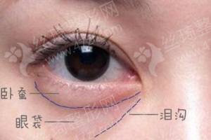 咸陽(yáng)做射頻緊膚機(jī)構(gòu)排名射頻緊膚案例過(guò)程分享,射頻緊膚項(xiàng)目術(shù)后體驗(yàn)日記點(diǎn)評(píng)-醫(yī)院實(shí)力簡(jiǎn)介