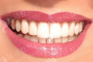 黃石做玻尿酸醫(yī)院排行榜醫(yī)院優(yōu)勢(shì)介紹_醫(yī)院優(yōu)勢(shì)介紹|醫(yī)院簡(jiǎn)介