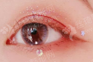 南昌做眼修復(fù)醫(yī)院排行榜醫(yī)院信息_眼修復(fù)術(shù)后恢復(fù)案例反饋!眼修復(fù)醫(yī)生術(shù)后案例記錄點(diǎn)評