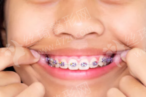 深圳做膠原蛋白除皺醫(yī)生排行榜附最近1年參考價(jià)錢,醫(yī)生簡(jiǎn)介!膠原蛋白除皺術(shù)后案例反饋