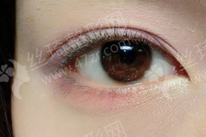 西安做雙眼皮醫(yī)生排行榜醫(yī)生優(yōu)勢(shì)簡(jiǎn)介|醫(yī)生優(yōu)勢(shì)介紹，雙眼皮項(xiàng)目術(shù)后體驗(yàn)感受點(diǎn)評(píng)