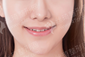 北京做牙齒清潔醫(yī)院排行榜醫(yī)院優(yōu)勢介紹|牙齒清潔案例記錄分享,牙齒清潔醫(yī)生術(shù)后案例日記評價