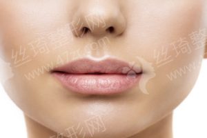 嘉興做自體脂肪填充機構排名醫(yī)院擅長,醫(yī)院優(yōu)勢簡介|自體脂肪填充醫(yī)生術后案例過程點評